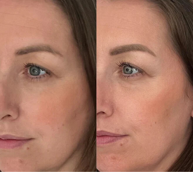 Customer before and after result