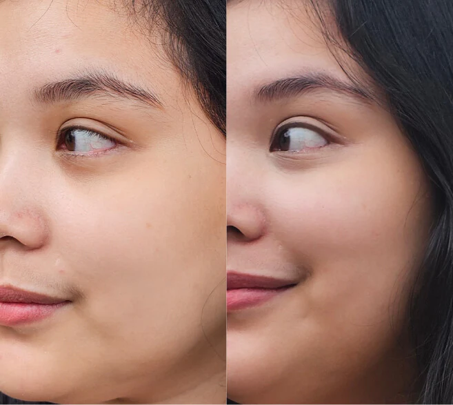 Customer before and after result