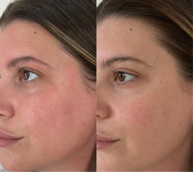 Customer before and after result