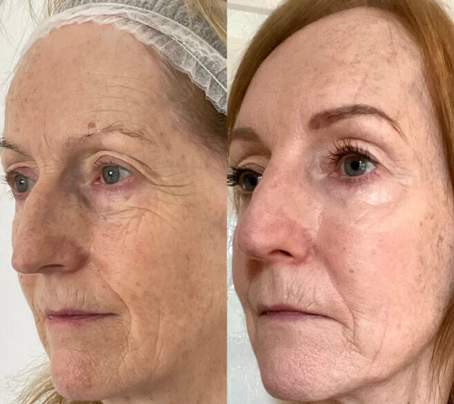 Customer before and after result