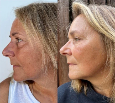 Customer before and after result