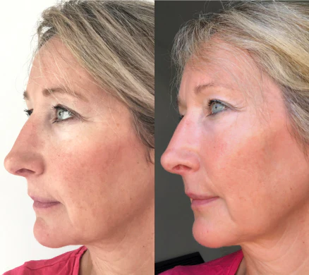 Customer before and after result