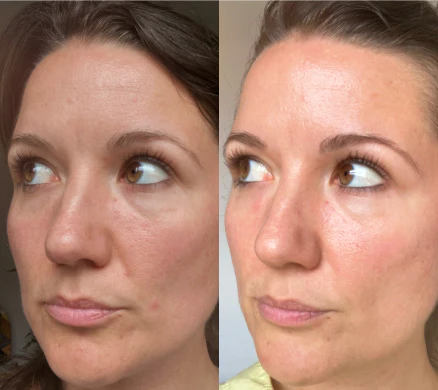 Customer before and after result