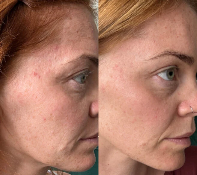 Customer before and after result