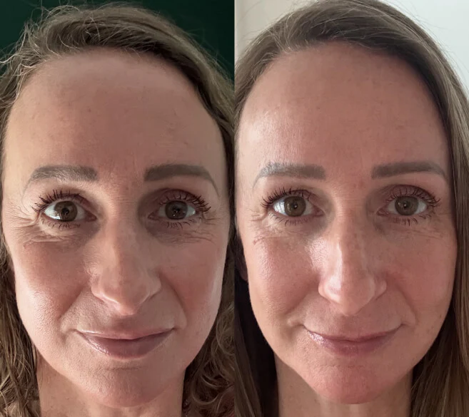 Customer before and after result