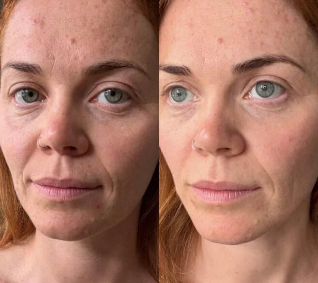 Customer before and after result