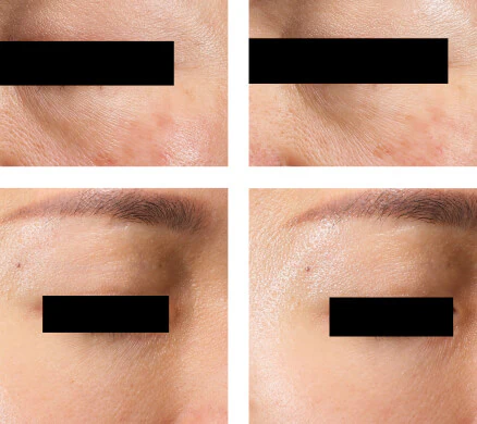 Customer before and after result