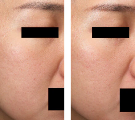 Customer before and after result