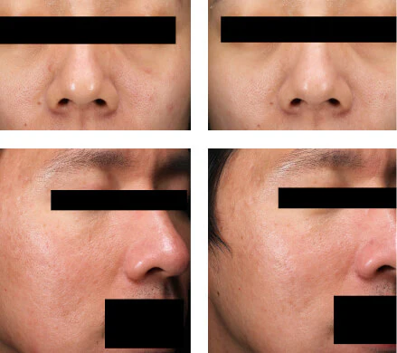 Customer before and after result
