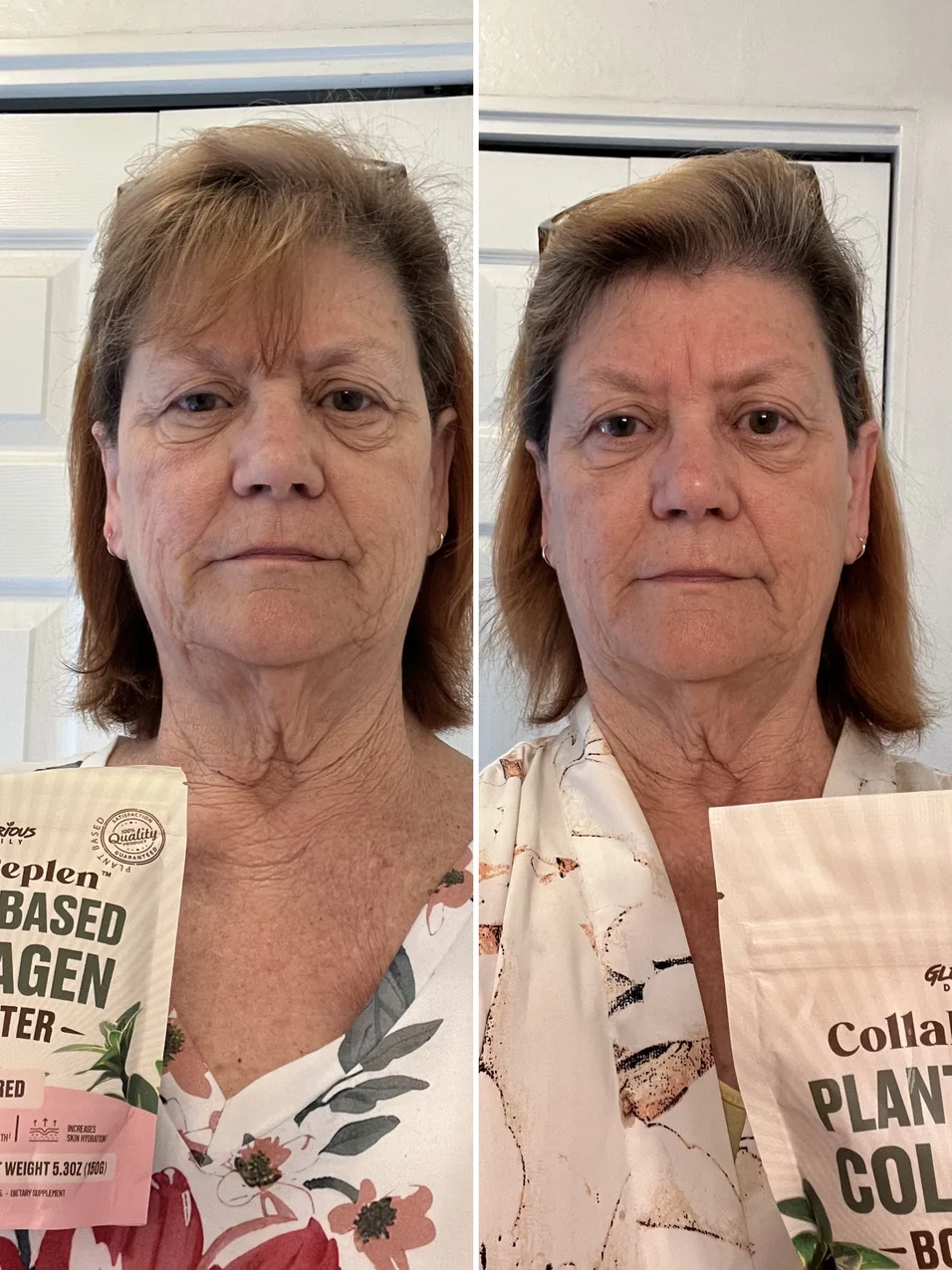 Customer before and after result