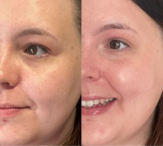 Customer before and after result