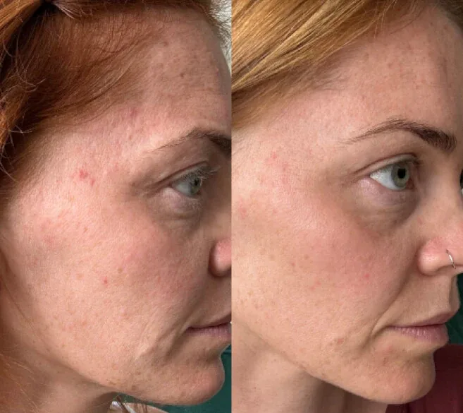 Customer before and after result